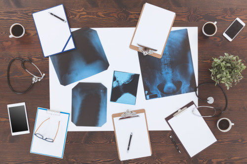 Mesa de trabajo con Radiografías médicas y carpetas de trabajo en blanco, simulando grupo de personas trabajando en temas de salud.